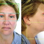 Sheryl Two Cosmetic Dermatology