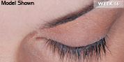 latisse-after CSI Latisse before and after