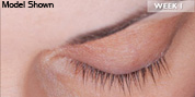 latisse-before-1 Latisse before and after