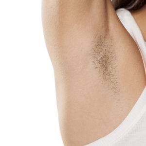 unwanted hair