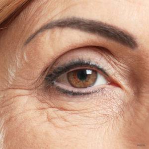 Heavy Wrinkle Reduction, California Skin Skin Insititute Heavy Wrinkle Reduction, California Skin Skin Insititute