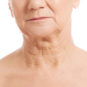 Neck Skin, California Skin Skin Insititute Neck Skin, California Skin Skin Insititute