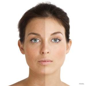 Sun Damage, California Skin Skin Insititute Sun Damage, California Skin Skin Insititute