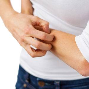 Eczema, California Skin Skin Insititute Eczema, California Skin Skin Insititute