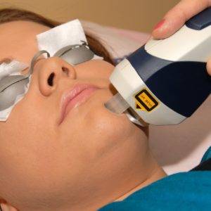 Laser Peel for Healthy Skin?, California Skin Skin Insititute Laser Peel for Healthy Skin?, California Skin Skin Insititute