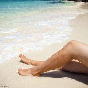 Leg Vein Laser Treatments, California Skin Skin Insititute Leg Vein Laser Treatments, California Skin Skin Insititute