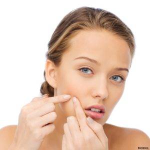 What’s Causing Your Acne?, California Skin Skin Insititute What’s Causing Your Acne?, California Skin Skin Insititute