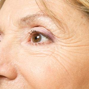 Wrinkles, California Skin Skin Insititute Wrinkles, California Skin Skin Insititute