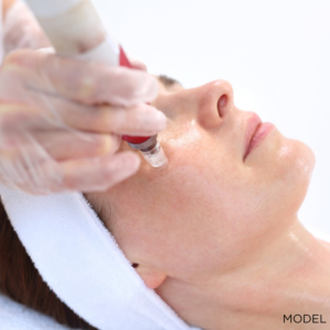 Banish the Brown Spots in Time for the Holidays, California Skin Skin Insititute Banish the Brown Spots in Time for the Holidays, California Skin Skin Insititute