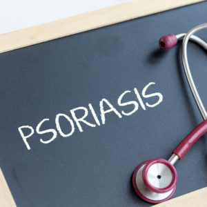 Living with Psoriasis: Causes and Misconceptions, California Skin Skin Insititute Living with Psoriasis: Causes and Misconceptions, California Skin Skin Insititute