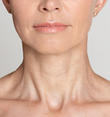 A Reason to Be Thankful: Turkey Neck Treatments that Work